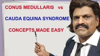 CONUS MEDULLARIS vs CAUDA EQUINA SYNDROME CONCEPTS MADE EASY [upl. by Ymmor]