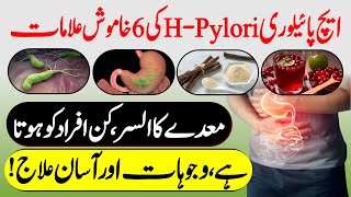 H Pylori Infection Urdu Hindi  H Pylori Treatment  Stomach Ulcer Treatment  Urdu Lab [upl. by Mahtal849]