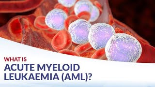 Classification of Acute Myeloid leukemia according to World health Organization [upl. by Aihsei923]