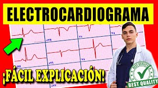 ELECTROCARDIOGRAMA Interpretación [upl. by Ericksen]