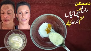 pigmentation treatment at home  chehre ki Chaiyan khtam Karne ka tarika [upl. by Naawaj859]