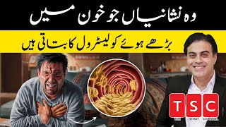 Cholesterol kaise kam kare  Cholesterol symptoms  Adeel mansoor [upl. by Trotta]