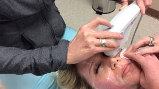 Ultherapy Under Eye Treatment  Woodlands Medical Aesthetics Institute [upl. by Ninazan227]