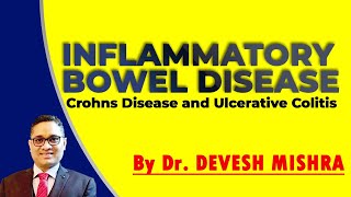 Inflammatory Bowel Disease  Crohns Disease and Ulcerative Colitis by Dr Devesh Mishra [upl. by Azne495]