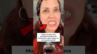 Se pone una dentadura postiza de Halloween ¡pero no se puede quitar 🦷🎃🤣 humor noticias risa [upl. by Crescantia]