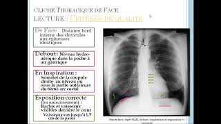 introduction à la radio pulmonaire [upl. by Misaq]