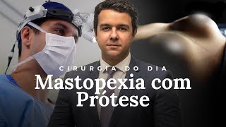 MASTOPEXIA COM PRÓTESE  Cirurgia do Dia  Dr Samuel Orige [upl. by Acirdna]