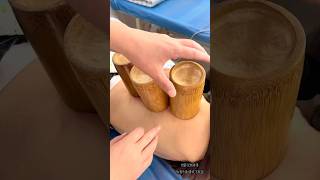 Cupping therapy restores health cuppingtherapy food relax satisfying massage [upl. by Jolee]