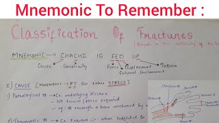 Classification Of Fractures  Simplified  How To Remember  Learn With Diagrams [upl. by Ruhtracam]