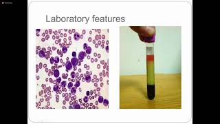 Myeloproliferative Disorders  3rd Year  Hematology Module  Pathology [upl. by Rains]