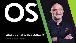 Video Surgery with commentary osteoplasty treatment for wall bone defect removal [upl. by Crutcher]