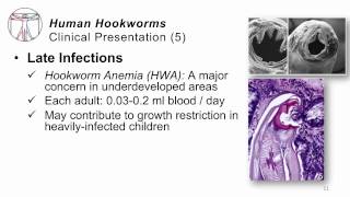 Helminths Hookworms [upl. by Mattie51]