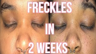 HOW I GOT REAL FRECKLES IN 2 WEEKS [upl. by Esilanna]