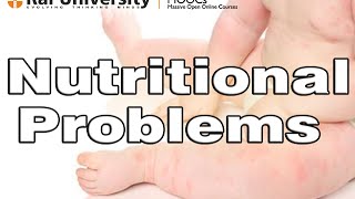 Nutritional problems – Child Nutrition [upl. by Rodie]