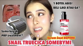 SNAIL TRUECICA SOMEBYMI EMPTIES Beli lagi gak   Marshella Eyya [upl. by Ermengarde455]