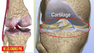 Comment Régénérer Le Cartilage Du Genou Naturellement amp Efficace À 100 [upl. by Etteroma]