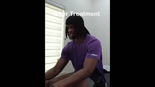 NFL Obi Melifonwu Shockwave Foot Pain Ankle Pain NFL Pain Therapy Chiropractic Katy Chiropractor [upl. by Eisset588]