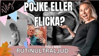 AVSLÖJAR könet på vår bebis vad är det i magen En pojke eller flicka Häng med på Rutinultraljud 🥰 [upl. by Eelanaj]