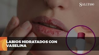 ✅ Protege tus labios del frío  Salud180 🌿 [upl. by Notsej]