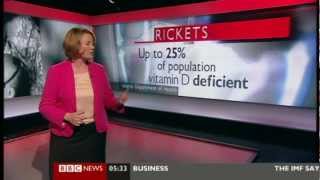 BRANWYN JEFFREYS BBC NEWS  21 April 2012  Rickets  Vitamin D deficient [upl. by Eenaffit785]