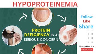 Hypoproteinemia Protein Deficiency Symptoms Causes [upl. by Sutherlan]