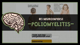 Poliomyelitis  3 NEUROINFECTIOUS DISEASE [upl. by Gelhar]