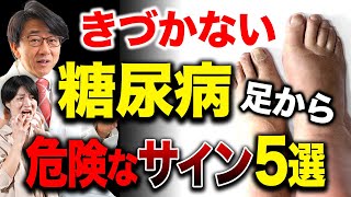 【眼科医解説】糖尿病、実は足からサイン出てるって知ってましたか？ [upl. by Hollenbeck]