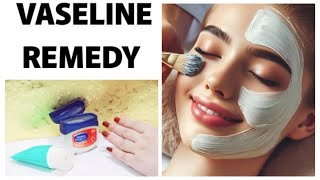 Vaseline ky fayde  Vaseline hacks  Vaseline skin whitening remedy by beauty with knowledge [upl. by Oludoet888]