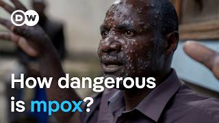 New mpox virus Why is it spreading so quickly  DW News [upl. by Wilkens729]