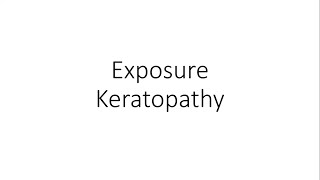 Exposure Keratopathy  Ophthalmology [upl. by Yank]