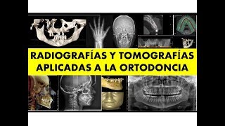 quotRADIOGRAFÍAS EXTRAORALES Y TOMOGRAFÍA CONE BEAM EN ORTODONCIAquot por el Dr Luis Arroyo [upl. by Ytisahc]