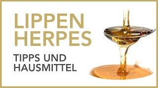 Lippenherpes  Tipps und Hausmittel  Dr Petra Bracht  Wissen Gesundheit [upl. by Meil961]