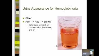 UA Lecture 6 Blood Bilirubin and Urobilinogen [upl. by Feldt590]