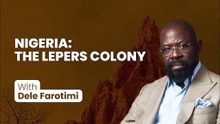 NIGERIA THE LEPERS COLONY [upl. by Frangos]