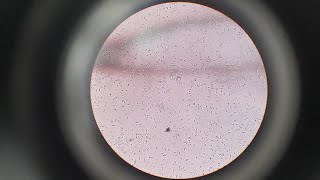 Semen Analysis Test  Microscopic Examination of Semen Test  Semen Test Procedure [upl. by Gurl857]