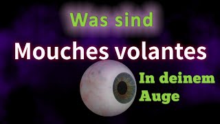 Mouches volantes Richtige Sprechweise Bedeutung Korrekte Aussprache Gutes Deutsch Fleck im Auge [upl. by Roselle632]