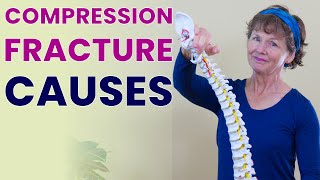 What Causes Compression Fractures [upl. by Bonnee]