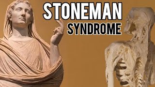 What is Stoneman Syndrome  Fibrodysplasia ossificans progressiva  FOP  Rare disease Stone man [upl. by Eneliak862]