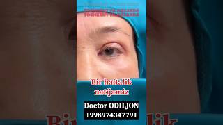 Qovoq olish  қовоқ олиш  blefaroplastika Doctor ODILJON 998974347791 TOSHKENT VA JIZZAXDA rek [upl. by Mar]