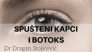 Botoks i spušteni kapci [upl. by Acirtap]