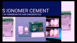 Glass Ionomer Cement GIC [upl. by Blight]