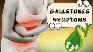 Gallstones  Signs amp Symptoms [upl. by Arrotal]