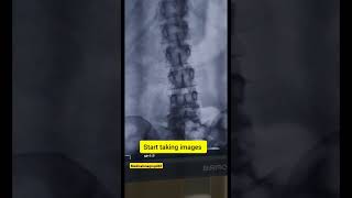 T Tube cholangiogram radiology hollywoodmovie memes learningradiology hollywoodproduction [upl. by Kcirre]