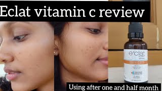 finally most requested review 😍☀️eclat vit C serum is this the magic potion 4 all your problemz🤔 [upl. by Eilsehc289]