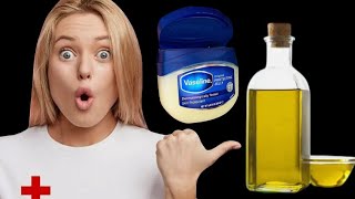 benefits of vaseline and aromatic ginger [upl. by Meaghan]