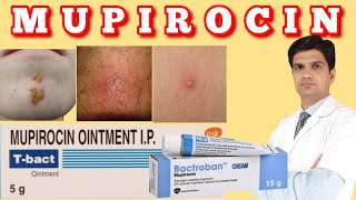 T bact ointment  Bactroban ointment  Mupirocin ointment uses side effects how to apply [upl. by Ainotna]