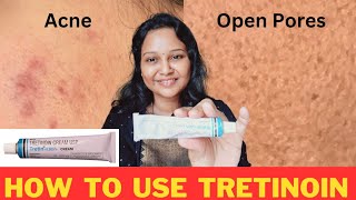 Tretinoin Cream  How to use TRETINOIN 0025 cream acneproneskin skincare acne viralproducts [upl. by Siegler513]