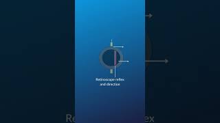 Types of retinoscopy reflex retinoscopy optometry eyeexam optomyze shorts [upl. by Johanna]