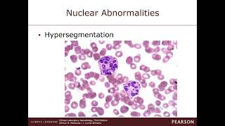 Chapter 21 Nonmalignant disorders of Granulocytes and Monocytes [upl. by Budworth]