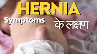 Symptoms of hernia  Hernia ke lakshan  हर्निया के लक्षण  Hernia symptoms in Hindi [upl. by Dennie]